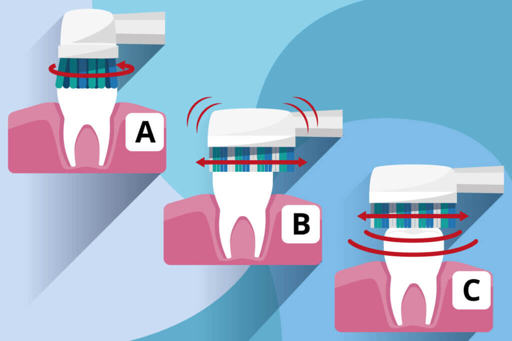 electric tooth brush types