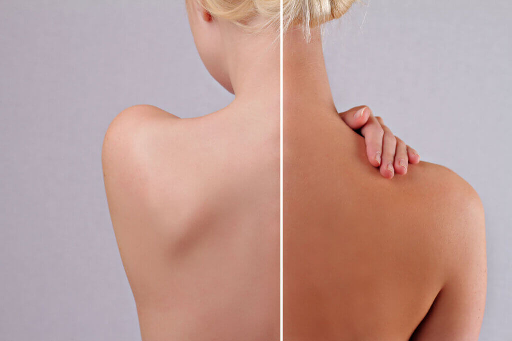 Back of a woman with and without self-tanner